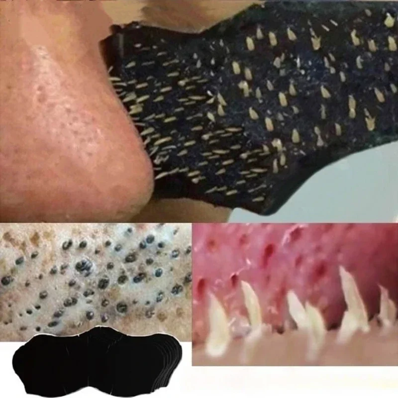 Unisex Blackhead Remove Mask N - Skincare Viral Tiktok recensie en prijs