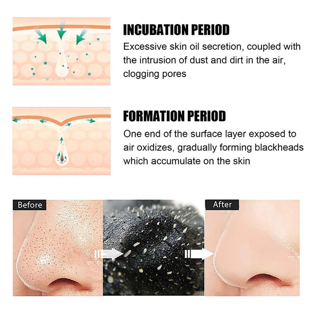 10/20/50/100PCS Mee-eter Verwi - Charcoal Pore Strip recensie en prijs